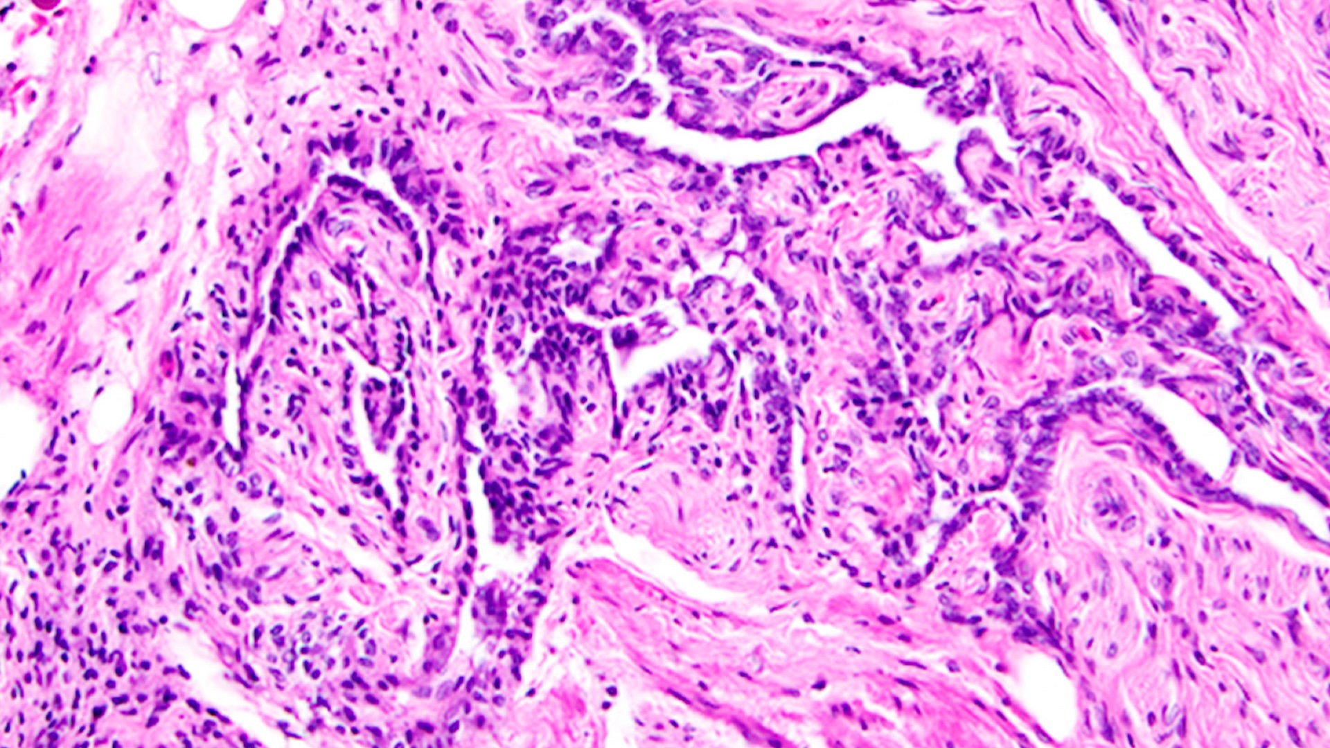 Забытый орган в женском теле оказался ключом к фертильности