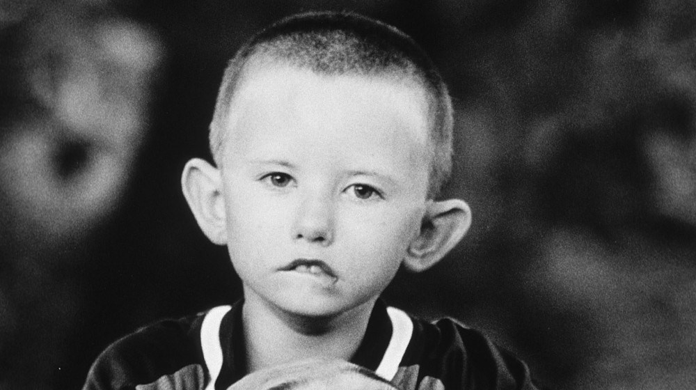 Синдром Мёбиуса когда лицо не умеет улыбаться