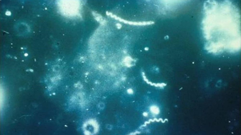 Раскрыта тайна происхождения сифилиса ученые наконец пролили свет на давний вопрос