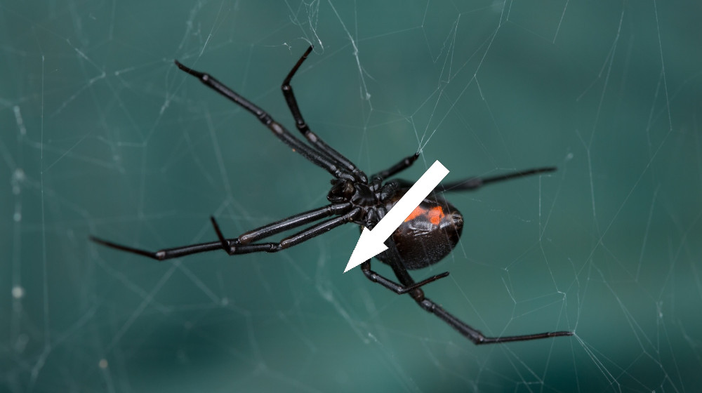 Diagnostic dilemma: Black widow spider's venom poisoned a woman through her eyeball 