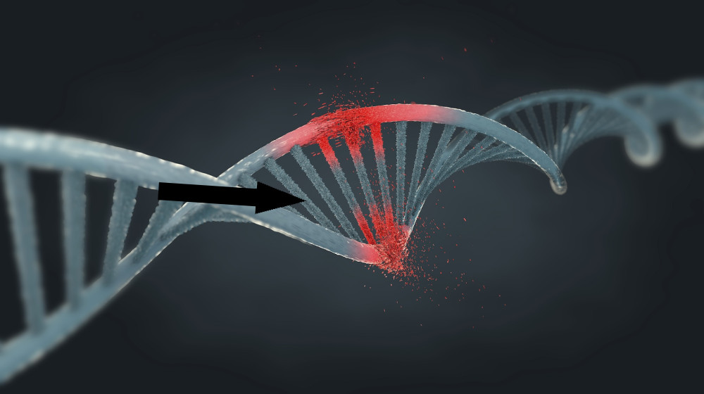  Werner syndrome: A rare inherited condition that causes dramatic, early aging 