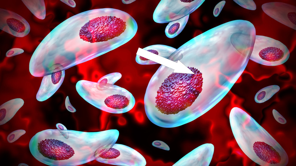 Паразит, лишающий мужчин сперматозоиды головы, шокирует ученых