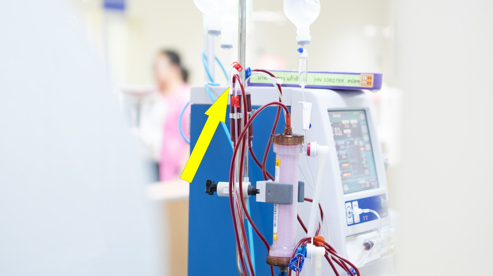  Diagnostic dilemma: A woman started eating foam from her chair while receiving dialysis 