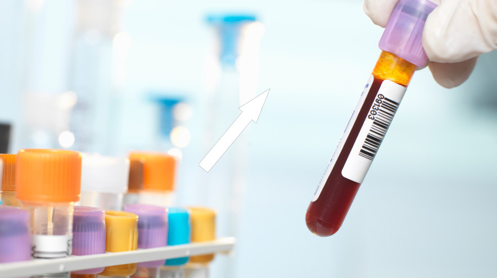 Уникальный и неизученный кровяной тип найден у единственной женщины на Земле Гваделупа