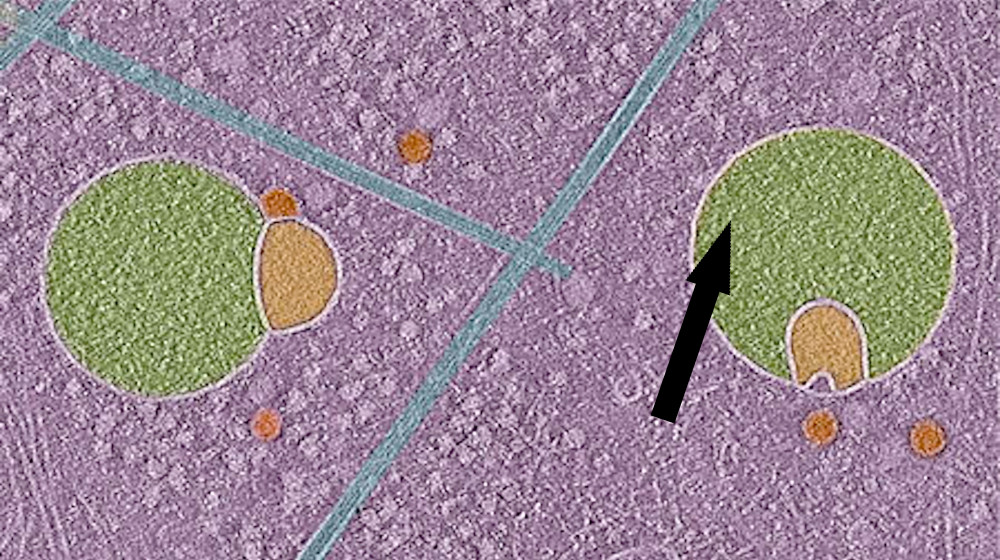  Scientists discover never-before-seen part of human cells — and it looks like a snowman wearing a scarf 