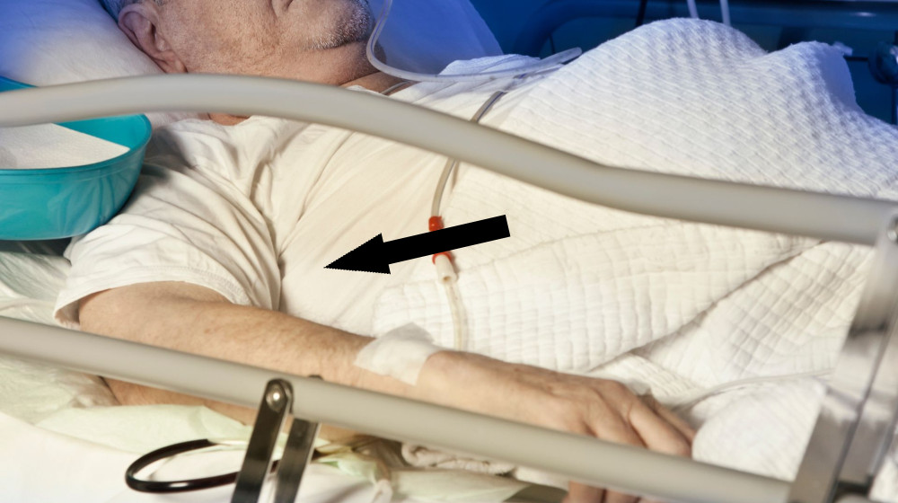  Diagnostic dilemma: Shingles popped a hole in a man's bladder 