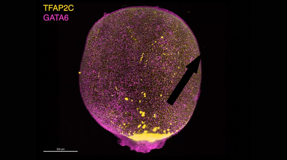  Scientists grow mini amniotic sacs in the lab using stem cells 