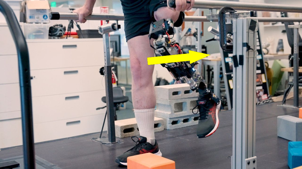  New bionic knee connects directly with muscles and bone to feel more like the user's body 