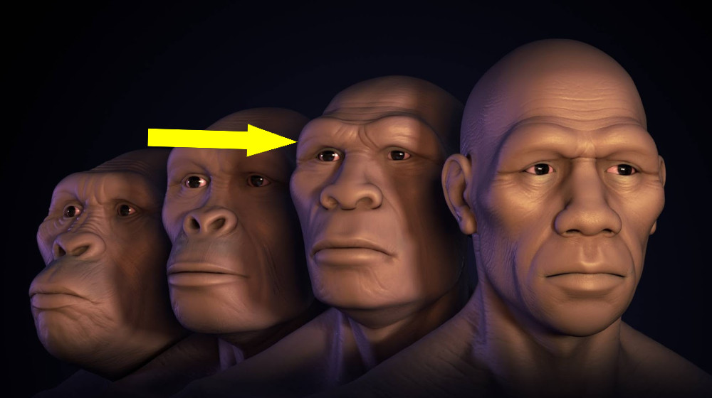 Гены Неандертальцев могут объяснить загадочный недуг с выпячиванием мозга из черепа