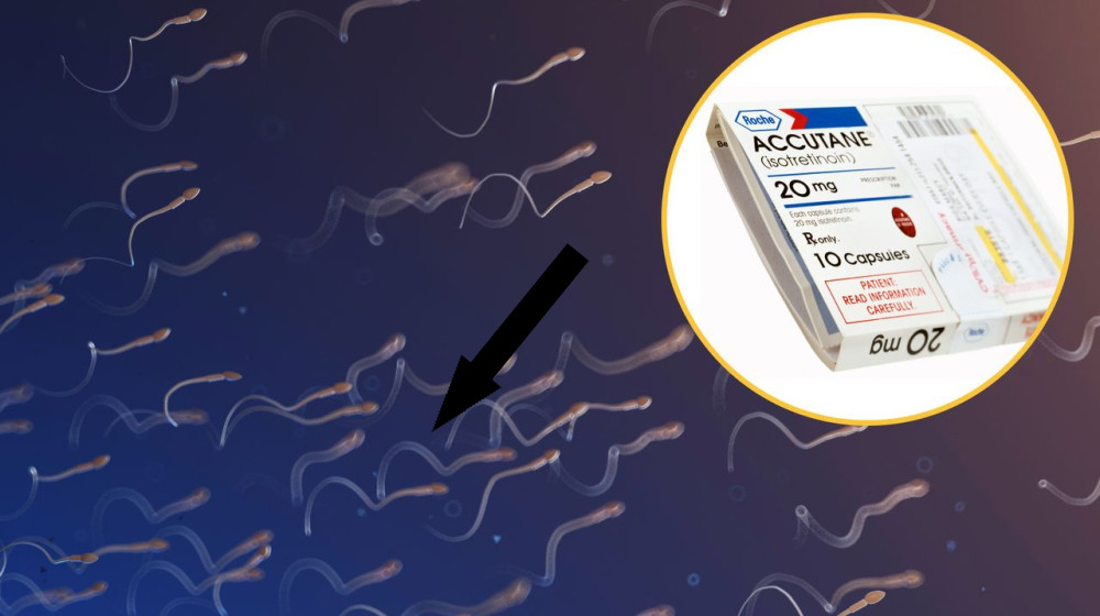 Лекарство от прыщей может вернуть мужскую фертильность — исследование показывает необычные результаты