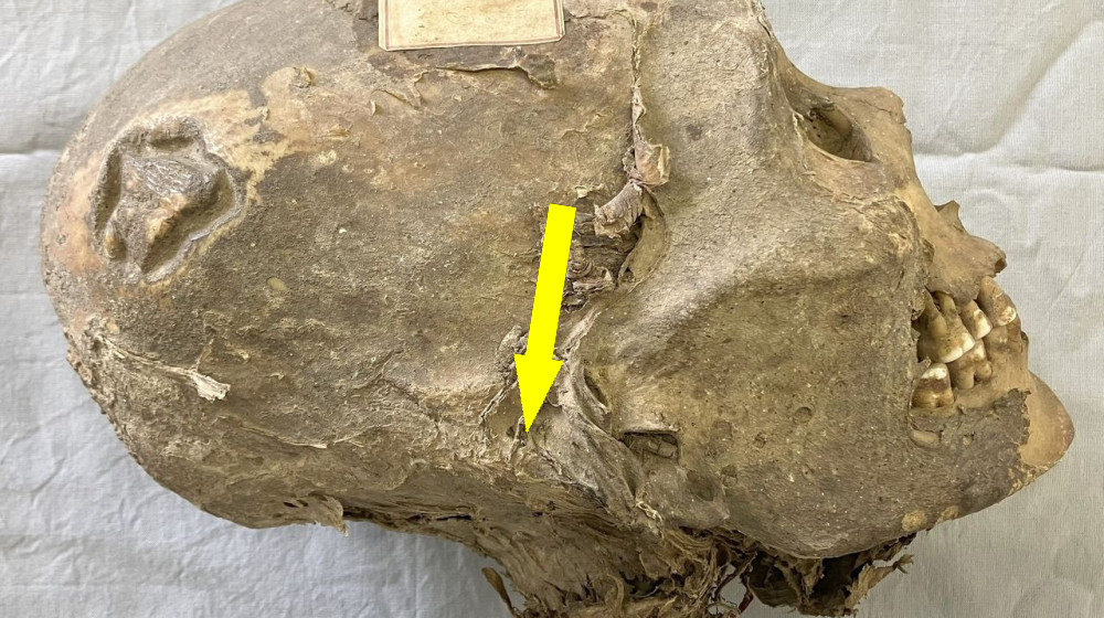  350-year-old mummified head from Bolivia isn't what it seems  