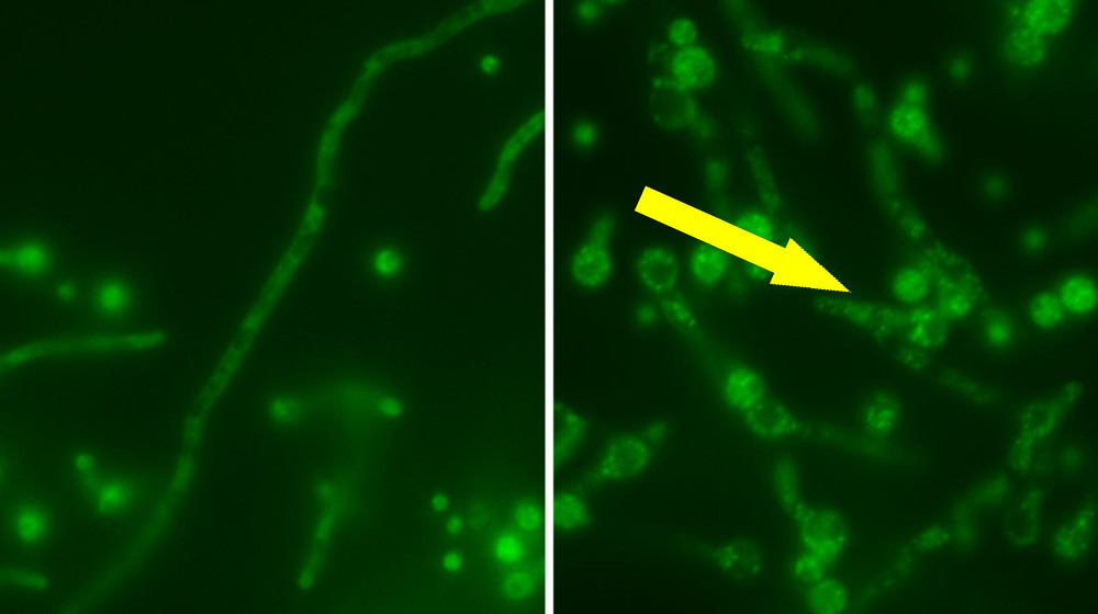 Русская матрешка вируса прячется внутри смертельных грибов и делает их опаснее для людей