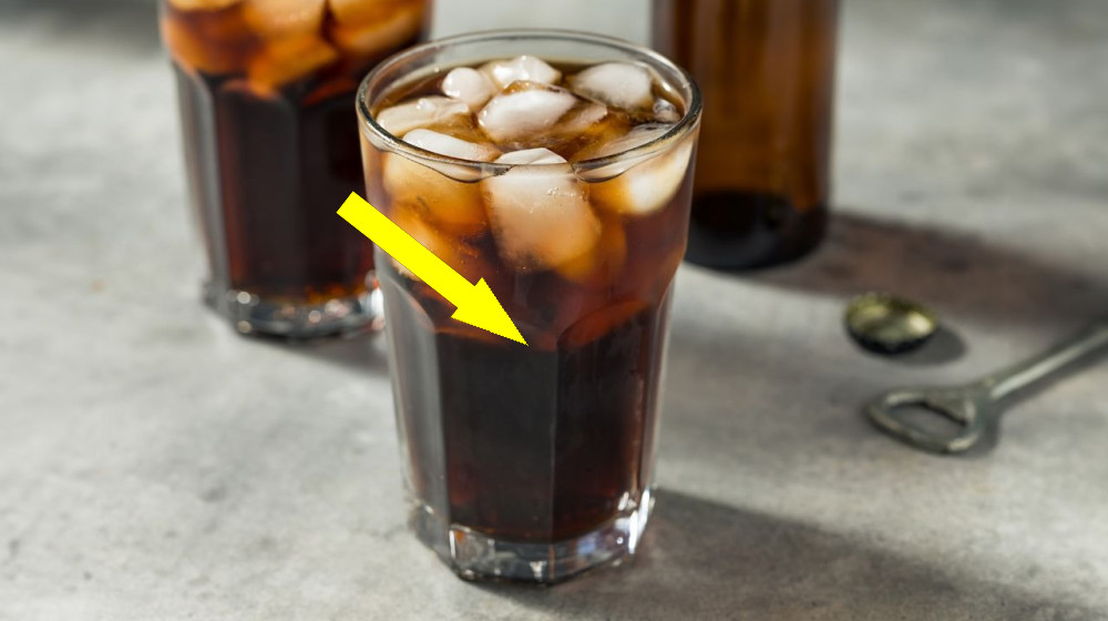  Diagnostic dilemma: A woman's nausea was triggered by a huge mass in her stomach — which doctors dissolved with diet soda 