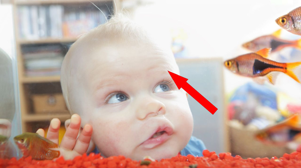  Diagnostic dilemma: A baby suddenly started to smell of rotting fish 