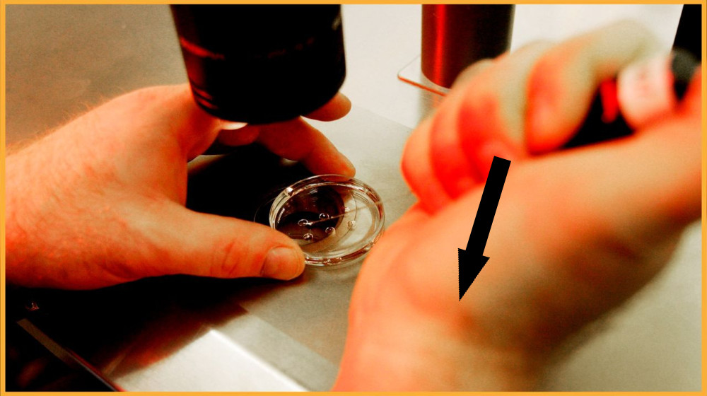  Restrictions on fetal tissue research would threaten progress on breakthrough treatments for devastating diseases — and yet not prevent a single abortion 