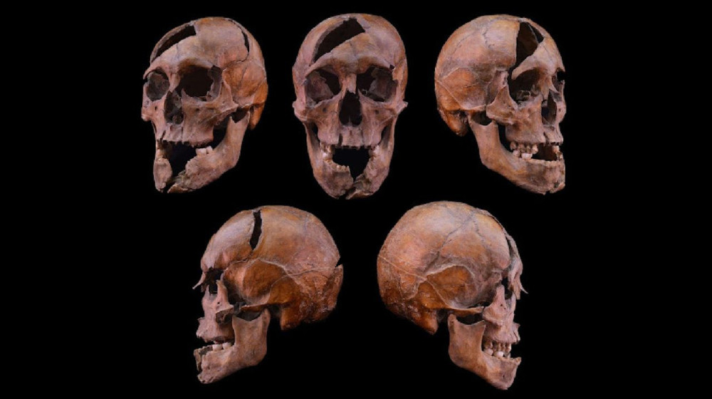  Medieval Hungarian duke was murdered in a brutal and coordinated attack, forensic analysis reveals  