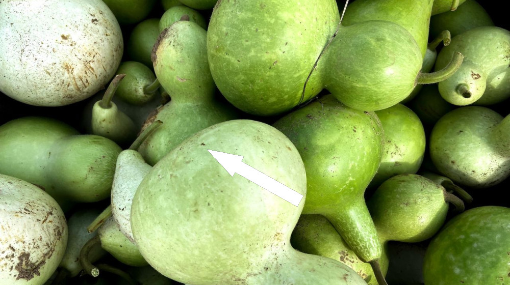  Diagnostic dilemma: A woman's homemade juice led to life-threatening 'toxic squash syndrome' 