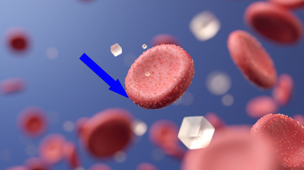  New drug could prevent diabetes complications not fixed with blood sugar control, study hints 