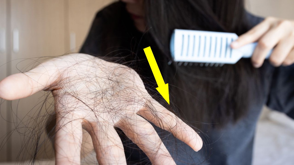 Наконец-то раскрыта тайна стрессового облысения