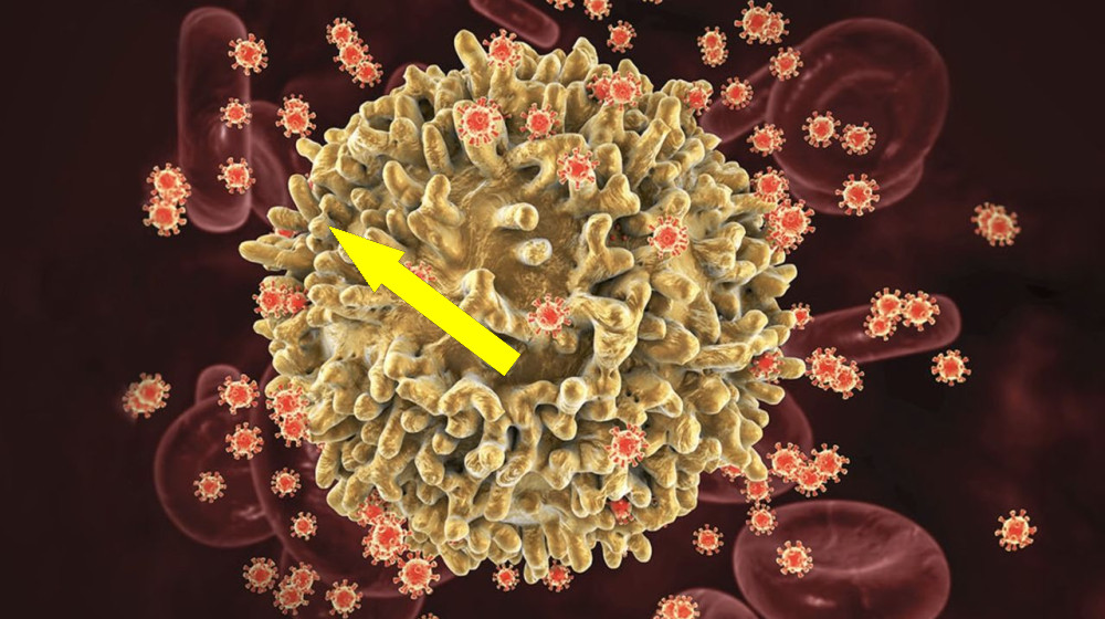  A 'functional cure' for HIV may be in reach, early trials suggest 