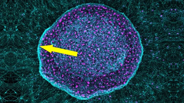  'Pain sponge' derived from stem cells could soak up pain signals before they reach the brain 