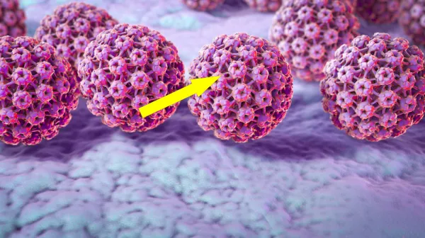  Ötzi the Iceman mummy carried a high-risk strain of HPV, research finds 