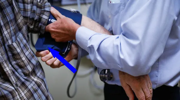  People with more 'brown fat' have healthier cardiovascular systems. A new study in mice may explain why. 