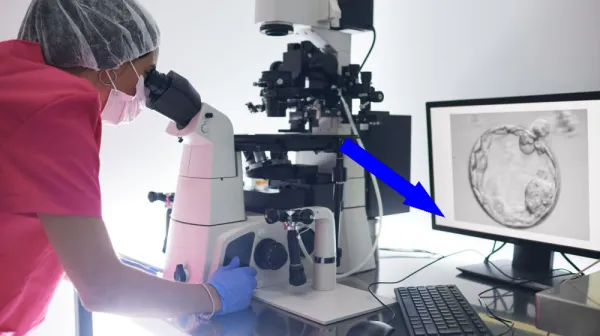  IVF hormones could be delivered with painless 'microneedle' patch someday, early study hints 