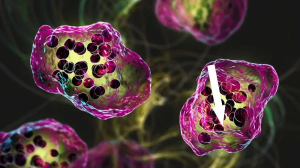 Южная Каролина на грани масштабной эпидемии кори — рекорд за десятилетия