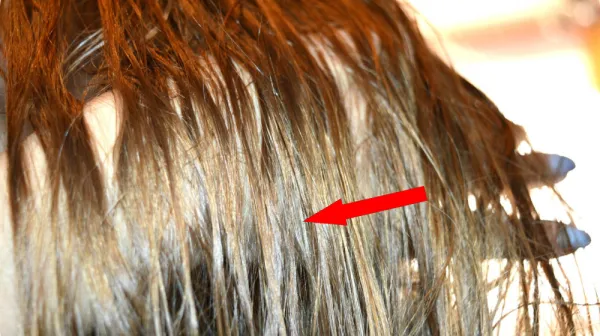 Загадка «химио-кудрей»: почему волосы меняют структуру после рака?