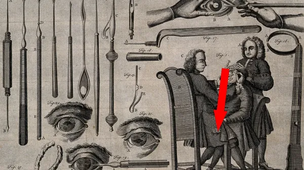 Древний клещ для черепных операций. Тайны 2300-летней находки в Польше