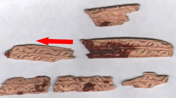  'I had never seen a skull like this before': Medieval Spanish knight who died in battle had a rare genetic condition, study finds 