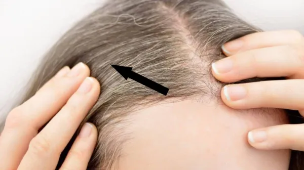 Могут ли седые волосы защитить от рака Впечатляющее открытие ученых