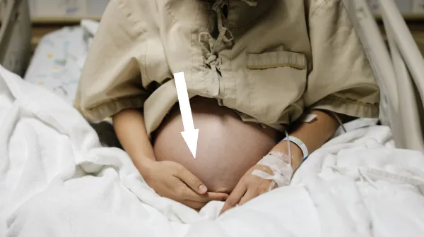  Risk of death from pregnancy in the US is 44 times higher than that from abortion, new analysis reveals 