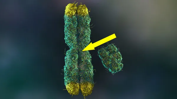  Many men lose their Y chromosomes as they age. It may shorten their lives. 