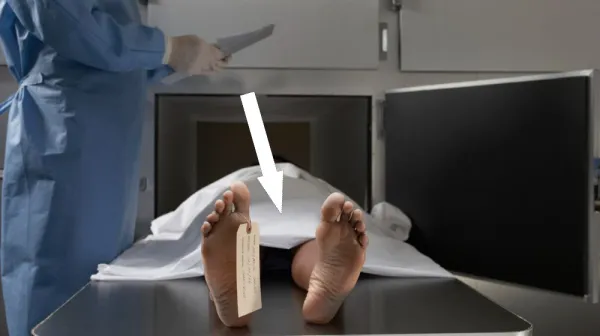  What is rigor mortis, and why does it happen? 