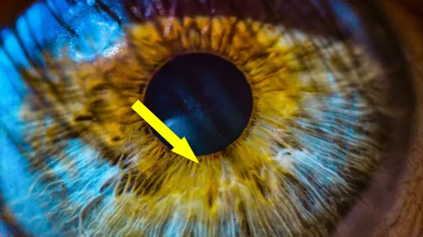  Inherited diseases don't work like we thought they did 