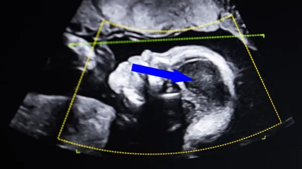 Когда ДНК показывает правду: кто ты на самом деле?
