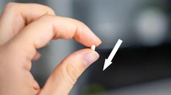  Diagnostic dilemma: A doctor discovered the gene mutation behind his family's mysterious missing-teeth condition 