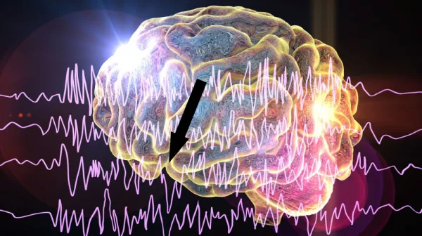  In people with epilepsy, sleeping after a seizure may trigger more seizures 