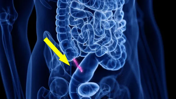 Аппендикс оказался куда важнее, чем думали ученые