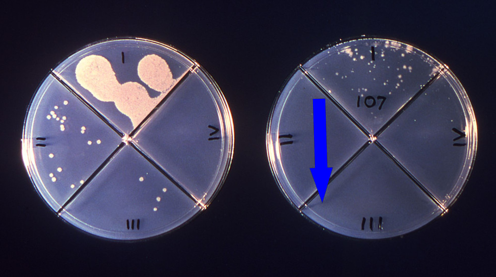 Мы будем бороться за него История Генри Рейдера и вызовы лекарственно-устойчивого туберкулеза