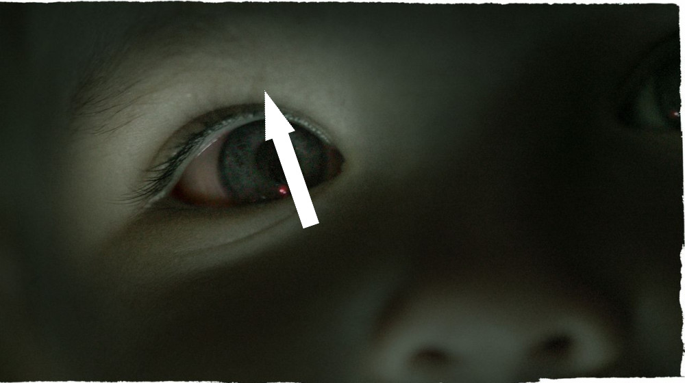 Новый компонент свиного семени открывает путь к лечению трудноизлечимых глазных раков