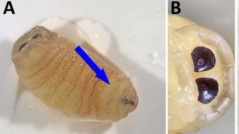 Женщина выплюнула червей из носа: загадочное заболевание или научная загадка?