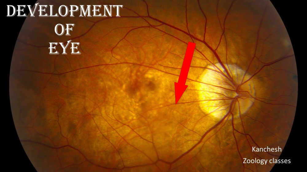  Early data links Wegovy to risk of 'eye stroke' — here's what to know 