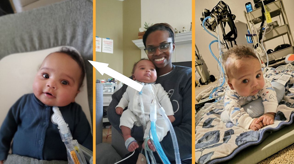  'Two lives hang in the balance': Risky surgery in the womb saved baby from deadly disorder at just 25 weeks gestation 