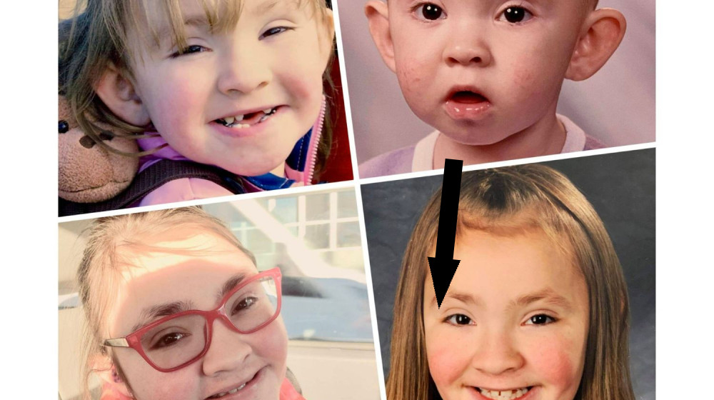  Diagnostic dilemma: An infant's brown eyes turned indigo after COVID antiviral treatment 