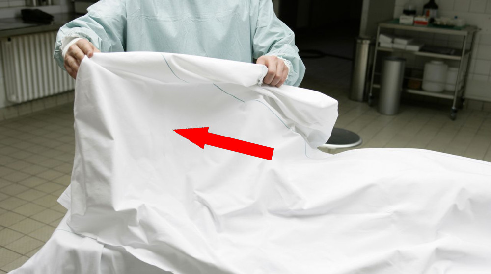  Diagnostic dilemma: Man who donated his body after death had rare 'triple penis' 